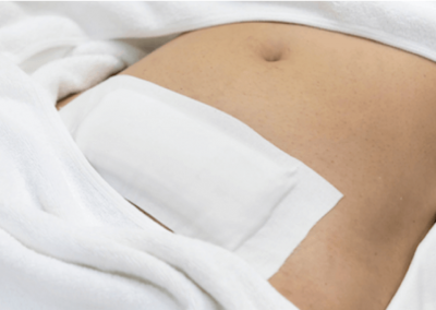 Abdominal myomectomy scar picture